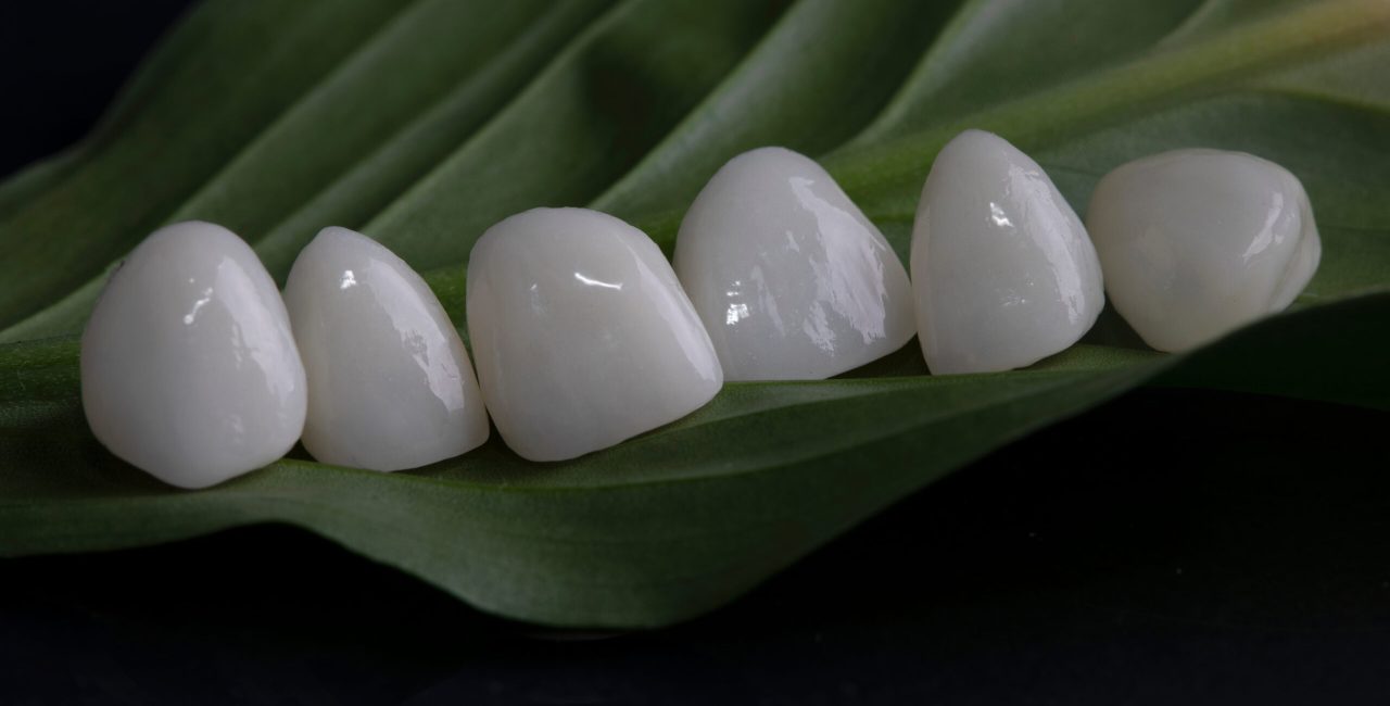 How Do Porcelain Veneers Fix Chips, Gaps, and Uneven Teeth