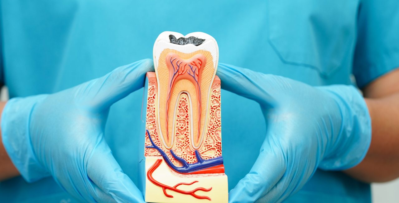 How Painful Is a Root Canal